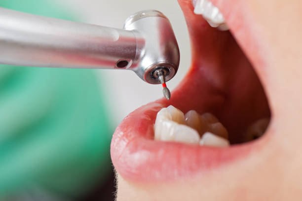 Best Emergency Treatment for Toothache in Holland, OH